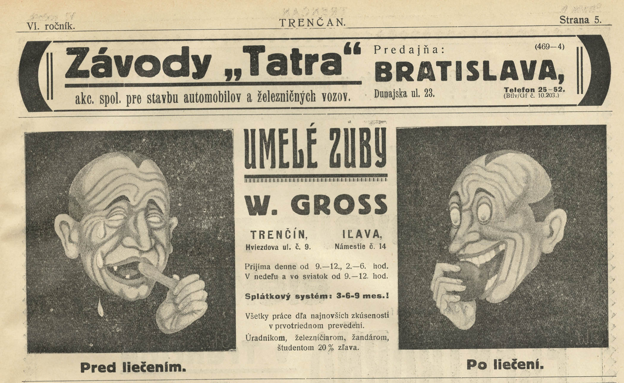 Obrázok č. 4 Reklama na zubnú protézu od W. Grossa z roku 1929